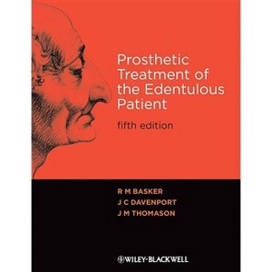 Prosthetic Treatment 5e - 5th Edition by  R M Basker & J C Davenport & J M Thomason (Paperback) - 1 of 1