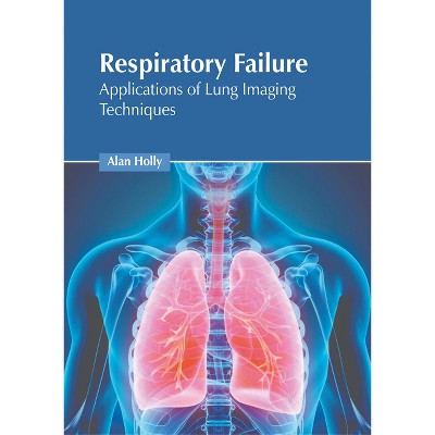 Respiratory Failure: Applications of Lung Imaging Techniques - by  Alan Holly (Hardcover)