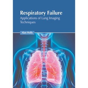 Respiratory Failure: Applications of Lung Imaging Techniques - by  Alan Holly (Hardcover) - 1 of 1