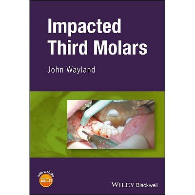 Impacted Third Molars - by  John Wayland (Hardcover)