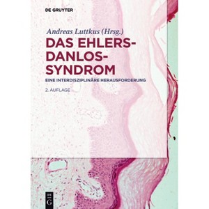 Das Ehlers-Danlos-Syndrom - 2nd Edition by  Andreas Luttkus (Hardcover) - 1 of 1