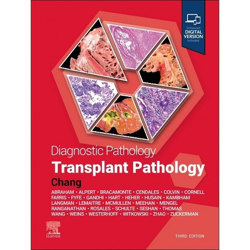 Diagnostic Pathology: Transplant Pathology - 3rd Edition by  Anthony Chang (Hardcover) - image 1 of 1