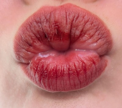 Guest review image 2 of 4, zoom in