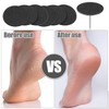 Unique Bargains Replacement Sandpaper Pad for Electric Foot File - 2 of 4