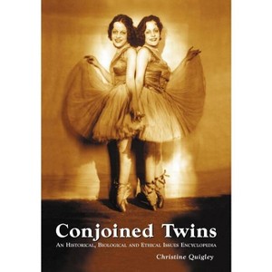 Conjoined Twins - by  Christine Quigley (Paperback) - 1 of 1