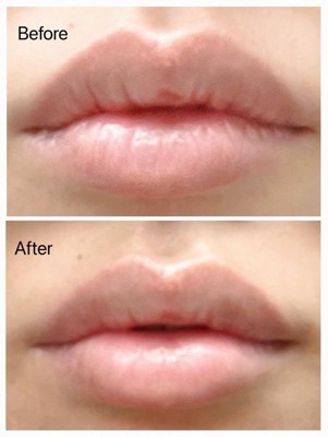 Guest review image 1 of 2, zoom in