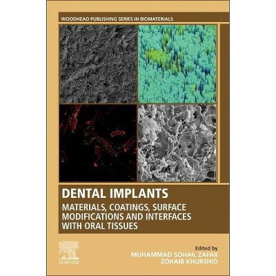 Dental Implants - (Woodhead Publishing Biomaterials) by  Muhammad Sohail Zafar & Zohaib Khurshid (Paperback)