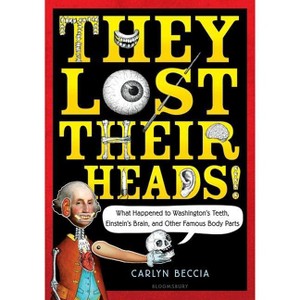 They Lost Their Heads! - by  Carlyn Beccia (Paperback) - 1 of 1