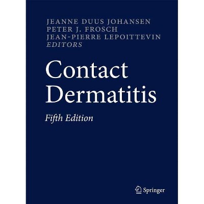 Contact Dermatitis - 5th Edition by  Jeanne Duus Johansen & Peter J Frosch & Jean-Pierre Lepoittevin (Hardcover)