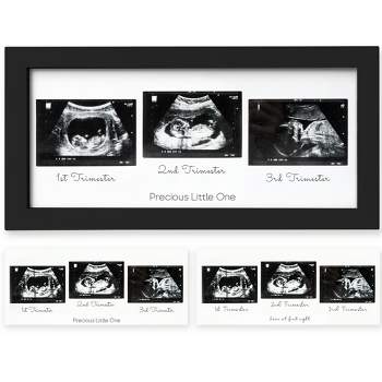KeaBabies Trio Baby Sonogram Picture Frame, Baby Ultrasound Picture Frames for Baby Nursery, Mom to Be Gifts