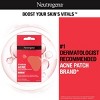 Neutrogena Stubborn Acne Ultra-Thin Blemish Hydrocolloid Patches, Combination Pack - 16 Patches - 3 of 4
