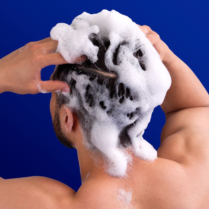 Head &#38; Shoulders Clinical Strength Anti-Dandruff Shampoo for Advanced Oil Control with 1% Selenium Sulfide - 13.5 fl oz, 4 of 20