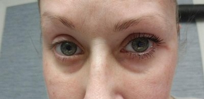 Guest review image 1 of 5, zoom in