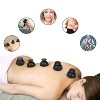 TRAKK Cupping Therapy Set 4pk - 4 of 4