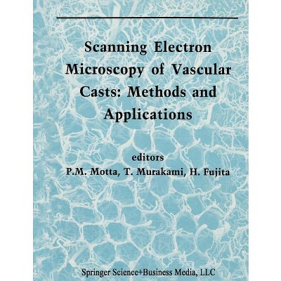Scanning Electron Microscopy of Vascular Casts: Methods and Applications - (Electron Microscopy in Biology and Medicine) (Paperback)