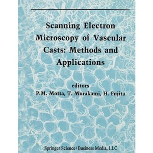 Scanning Electron Microscopy of Vascular Casts: Methods and Applications - (Electron Microscopy in Biology and Medicine) (Paperback) - 1 of 1