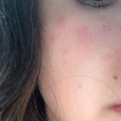 Guest review image 1 of 1, zoom in