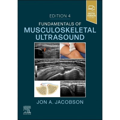 Fundamentals of Musculoskeletal Ultrasound - (Fundamentals of Radiology) 4th Edition by  Jon A Jacobson (Paperback)