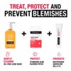 Neutrogena Oil-Free Acne Fighting Face Wash - Fragrance Free - 9.1 fl oz - 3 of 4