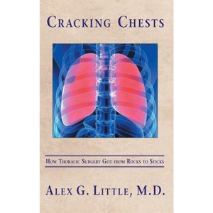 Cracking Chests - by  Alex Little (Hardcover) - 1 of 1