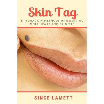 Skin Tag - by  Singe Lamett (Paperback)