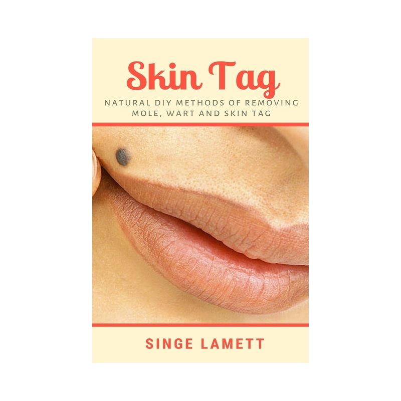 Skin Tag - by  Singe Lamett (Paperback), 1 of 2