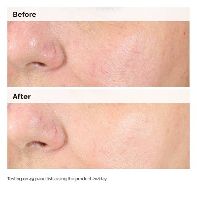 The Ordinary Alpha Arbutin 2% + Hyaluronic Acid for Hyperpigmentation - 1 fl oz - Ulta Beauty