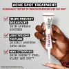 Thayers Natural Remedies Rapid Acne Spot Treatment with Glycolic Acid - 0.68 fl oz - 3 of 4