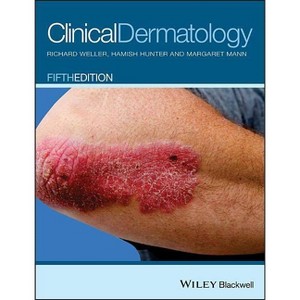 Clinical Dermatology - 5th Edition by  Richard B Weller & Hamish J a Hunter & Margaret W Mann (Paperback) - 1 of 1