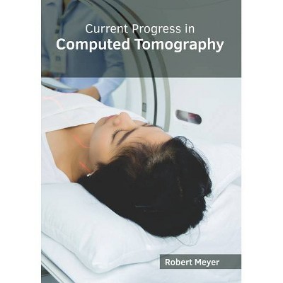 Current Progress in Computed Tomography - by  Robert Meyer (Hardcover)