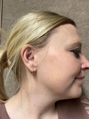 Guest review image 1 of 1, zoom in