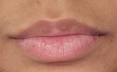 Guest review image 2 of 2, zoom in