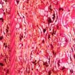 pink burst textured stencil
