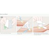 Molnlycke 285780 Mesalt Impregnated Dressing 6 in. x 6 in. (Each) - 3 of 3