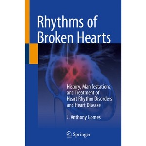 Rhythms of Broken Hearts - by  J Anthony Gomes (Paperback) - 1 of 1