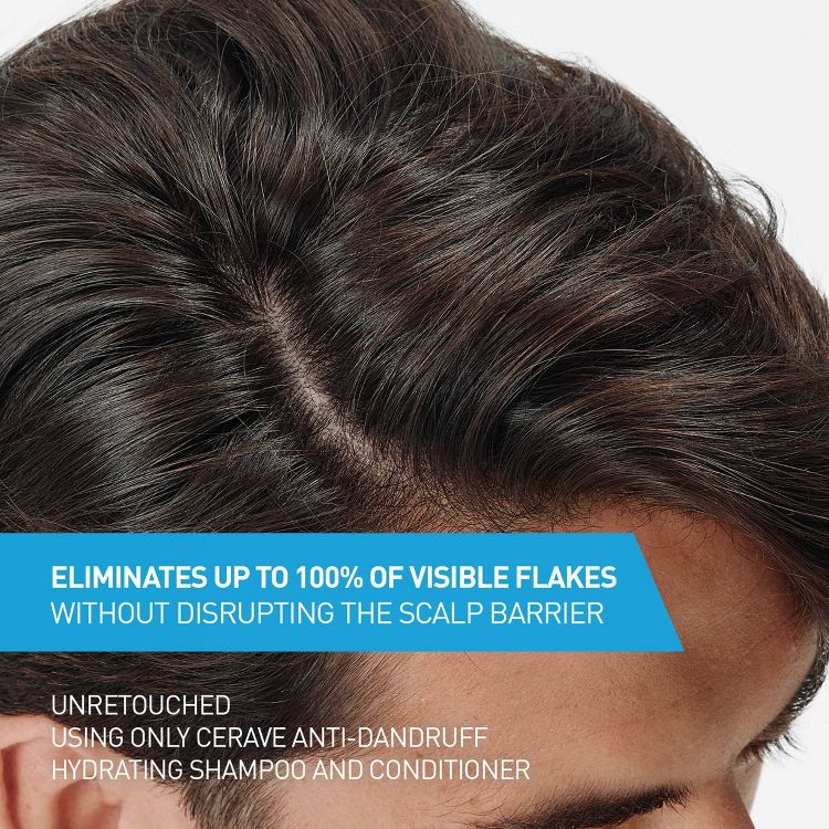 Close-up of a person's scalp with text stating "Eliminates up to 100% of visible flakes without disrupting the scalp barrier" and "Unretouched using only CeraVe Anti-Dandruff Hydrating Shampoo and Conditioner."