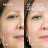 Dr. Brandt Dr. B Lab Brightening Peel Essence - Evens Skin Tone, Smooths Skin Texture & Improves Radiance - 3.4 fl oz - 2 of 4