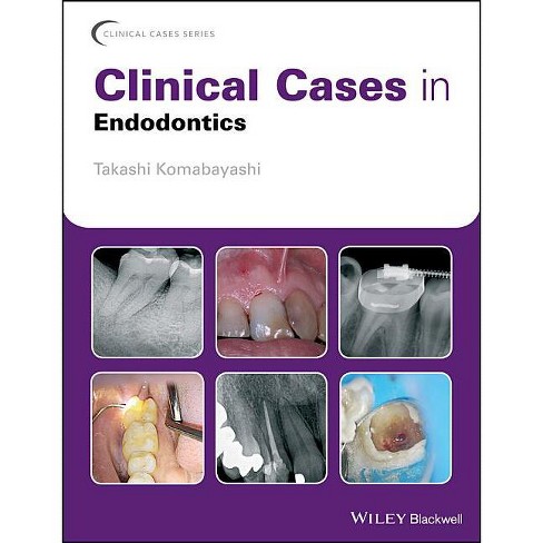 Clinical Cases In Endodontics - (clinical Cases (dentistry)) By 