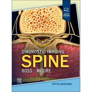 Diagnostic Imaging: Spine - 5th Edition by  Jeffrey S Ross & Kevin R Moore (Hardcover) - 1 of 1