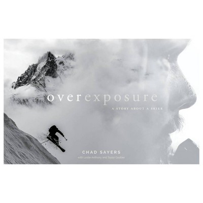 Overexposure - by  Chad Sayers (Hardcover)