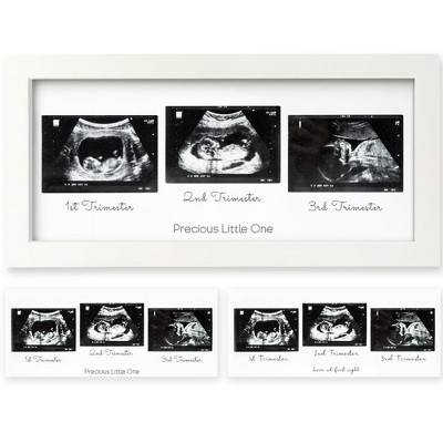 KeaBabies Trio Baby Sonogram Picture Frame, Baby Ultrasound Picture Frames for Baby Nursery, Mom to Be Gifts