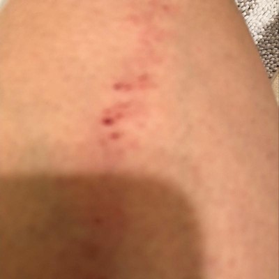 Guest review image 1 of 1, zoom in