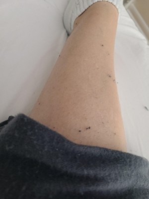 Guest review image 1 of 2, zoom in