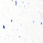 Blue Speckled