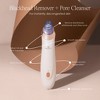 Project E Beauty Vana Blackhead Remover |Blackhead Remover Vacuum| Whiteheads Extractor | Pore Extractor Vacuum| Strong Suction | Minimized Pores - 2 of 4