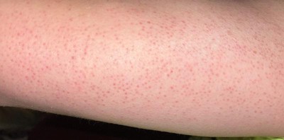 Guest review image 2 of 3, zoom in