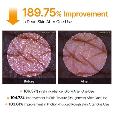 Dr.Melaxin Turmeric Facial Exfoliant Spray - 6.76 fl oz - Beauty Studio