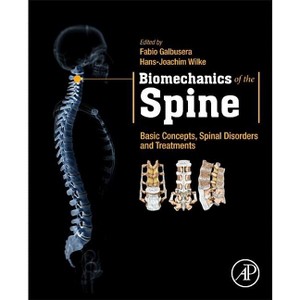 Biomechanics of the Spine - by  Fabio Galbusera & Hans-Joachim Wilke (Paperback) - 1 of 1