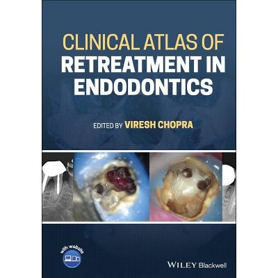 Clinical Atlas of Retreatment in Endodontics - by  Viresh Chopra (Hardcover)