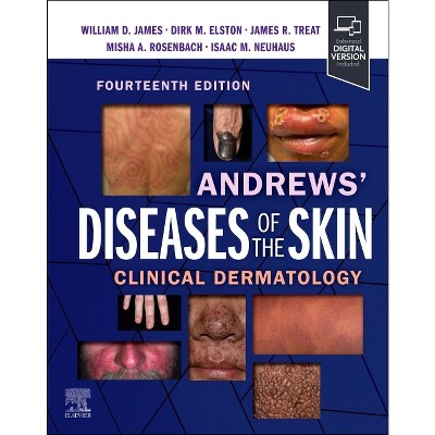 Andrews' Diseases of the Skin - 14th Edition by  William D James & Dirk M Elston & James R Treat & Misha Rosenbach (Hardcover)